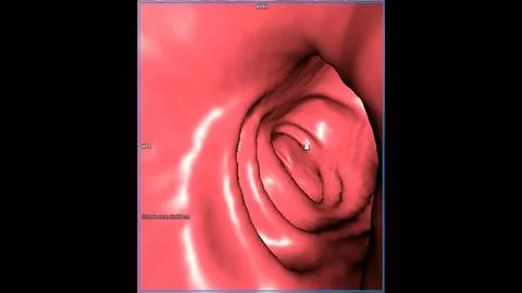 CT colonography  3D rendering image for annual health check-ups to screen f.. Stock Illustration