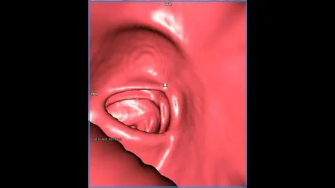 CT colonography  3D rendering image for annual health check-ups to screen f.. Stock Illustration