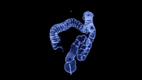 CT colonography , This imaging technique is often employed for colorectal c.. Stock-Illustration