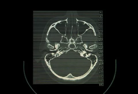Ct ( computed tomography imaging )scan image of brain. Stock Photos