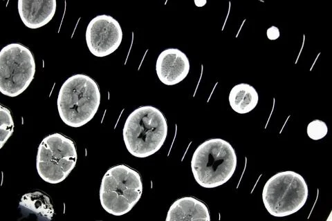 Ct file Stock Photos