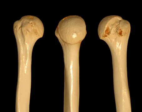 CT head of humerus 3D Clipping path. Stock Illustration