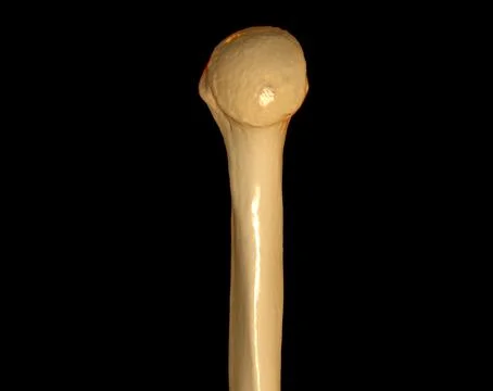 CT head of humerus 3D Stock Illustration