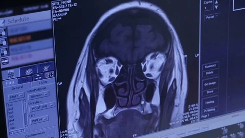 Ct human head brain scan, 4k footage Stock-Footage 75951734