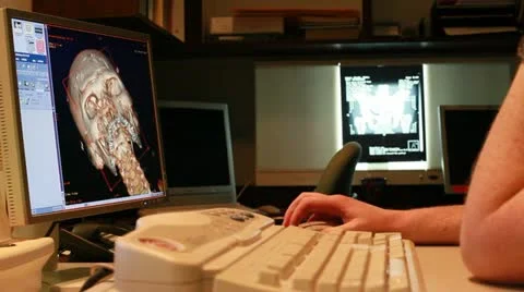 CT image on computer screen Stock Footage 11153108