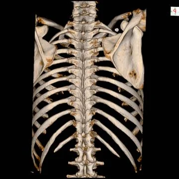 CT Scan 3D render Human Skeleton System (Thoracic Skeleton) Anatomy . Stock Photos