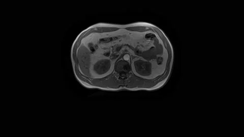 CT scan of the abdomen. Computed tomography of the gastrointestinal tract, liver Stock Footage 166158498