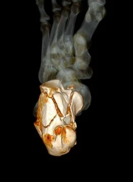 CT Scan ankle joint with  3d rendering of calcaneus bone showing Calcaneus .. Stock Illustration