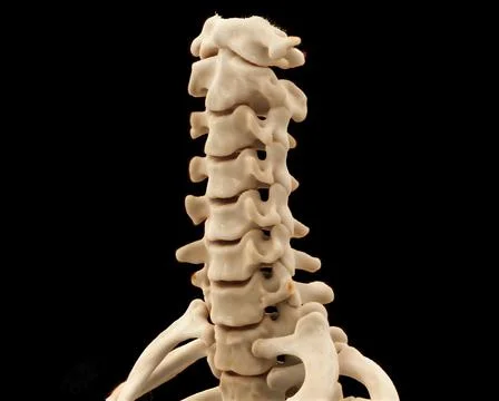 CT scan of C-Spine or Cervical spine 3D rendering  for diagnosis  fracture .. Stock Illustration