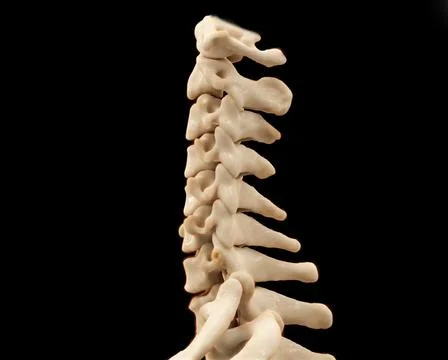 CT scan of C-Spine or Cervical spine 3D rendering  for diagnosis  fracture .. Stock Illustration