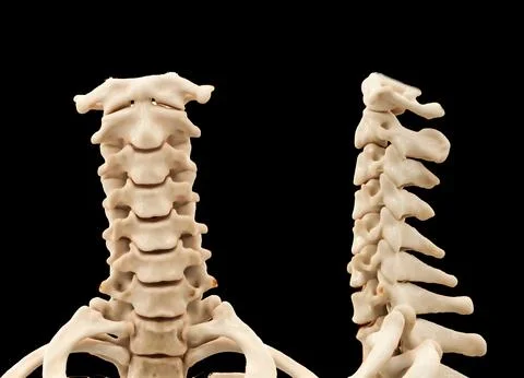 CT scan of C-Spine or Cervical spine 3D rendering  for diagnosis  fracture .. Stock Illustration