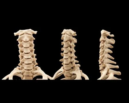 CT scan of C-Spine or Cervical spine 3D rendering  for diagnosis  fracture .. Stock Illustration