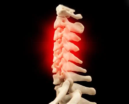 CT scan of C-Spine or Cervical spine 3D rendering . Stock Photos