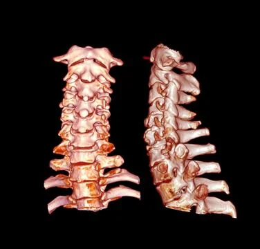 CT SCAN of Cervical Spine  3D rendering . Stock Illustration