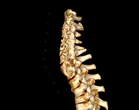 CT SCAN of Cervical Spine ( C-spine )  3D rendering image . 스톡 일러스트