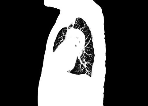 CT scan of Chest or lung  at radiology department in hospital. Covid-19 scan  Illustrazione stock