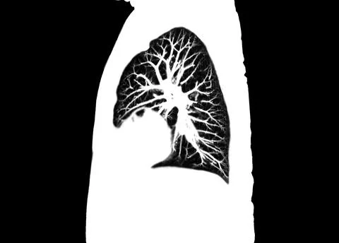CT scan of Chest or lung  at radiology department in hospital. Covid-19 scan  Stock-Illustration