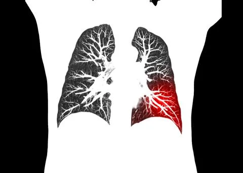 CT scan of Chest or lung  at radiology department in hospital. Covid-19 scan  Stock Illustration