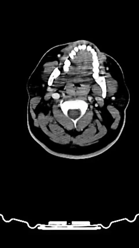 CT scan displaying cross-sectional view of human brain structure and cranial Stock Footage 303908916
