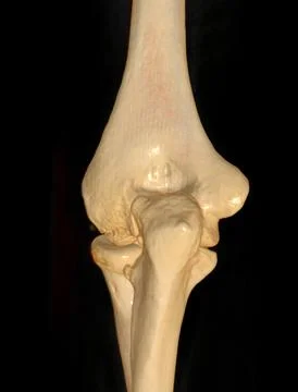 CT scan of elbow joint 3d rendering . Stock Illustration