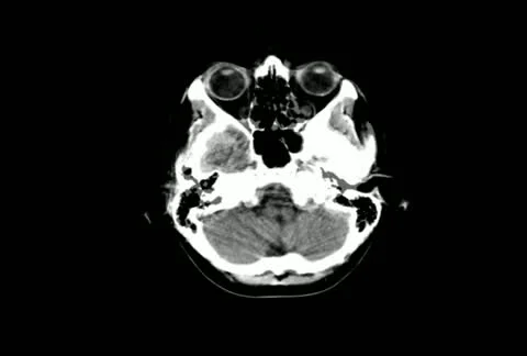 Ct scan Stock Footage 10821084