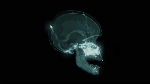 CT Scan of Head and Skull, CG animation 스톡 동영상 167092987