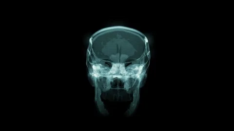 CT Scan of Head and Skull, CG animation 스톡 동영상 167092990