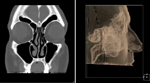 CT Scan of Head: Split screen review of 2D and 3D rendering Stock Footage 37207379