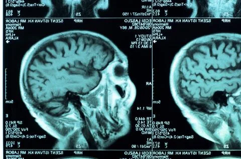 Ct scan of the human brain tile Stock Photos