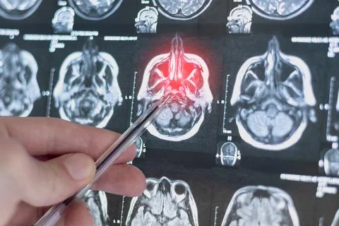 CT scan image of human brain. Mri or x-ray scan for diagnostic human head d.. Stock Photos