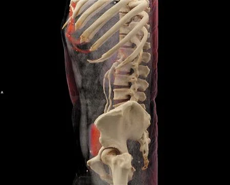 CT scan of Kidney and Urinary bladder system: KUB 3D rendering image  showi.. Stock Illustration