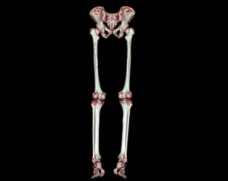 CT scan of lower extremity  3D . Stock Illustration
