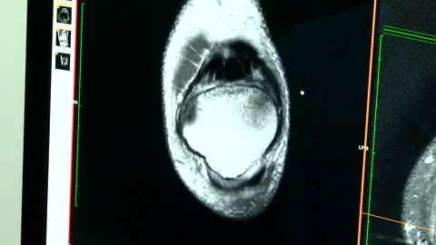 CT scan of patient in dynamic Stock-Footage 160362109