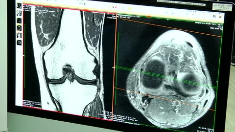 CT scan of patient in dynamic Stock Footage 160362360