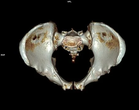 CT scan of Pelvic bone and hip joint 3D Stock Illustration