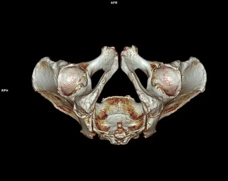 CT scan of Pelvic bone and hip joint 3D Illustrazione stock