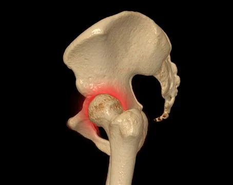 CT scan of Pelvic bone and hip joint 3D rendering for diagnosis fracture of P Stock Illustration