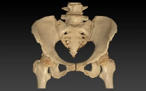 CT Scan of pelvic bone with both hip joint 3D rendering image isolated on bla Stock Illustration