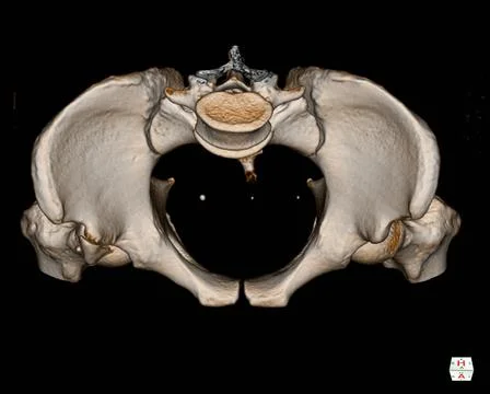 CT Scan Pelvis Bone 3D rendering image isolated on black background showing T イラスト素材
