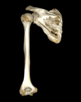 CT scan of shoulder joint and humerus bone or arm. Illustrazione stock