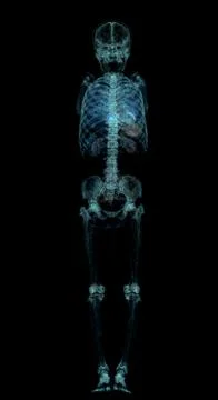 CT scan of whole human body. Stock Illustration