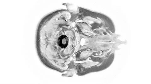 CT scan of a woman's head Stock Footage 64803760