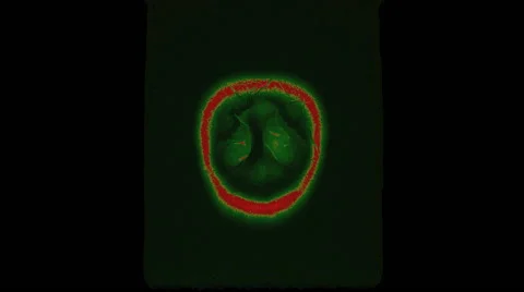 CT scan of a woman's head 스톡 동영상 64803763
