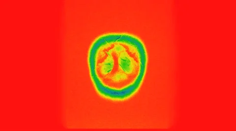 CT scan of a woman's head 스톡 동영상 64803764