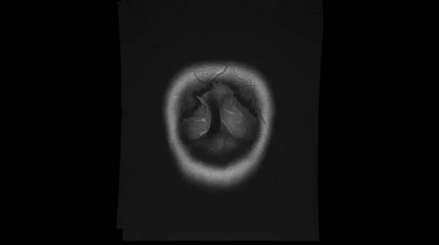 CT scan of a woman's head Stock Footage 64803769