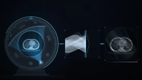 CT Scanner Gantry Scan and Image Reconstruction Medical Explainer Animation Видео 347525527