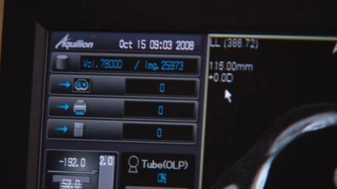 CT scanner screen blurred. Hospital reviewing data of patient B Stock Footage 115503547