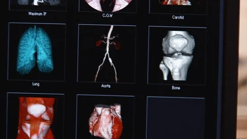 CT scanner screen menu at hospital 3D view of parts of body C Stock Footage 115503585
