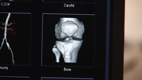 CT scanner screen menu at hospital 3D view of parts of body B Stock Footage 115503594