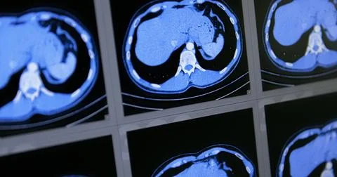 CT scans as background texture closeup photo Stock Photos